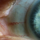 Illustration for article titled Shooting Challenge Eye Gallery 1